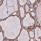 Anti-DNAJC3 Antibody