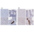 Anti-CYP51A1 Antibody