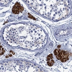 Immunohistochemical staining of human testis shows weak to moderate cytoplasmic positivity in Leydig cells.