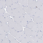 Immunohistochemical staining of human skeletal muscle shows no cytoplasmic positivity in myocytes.