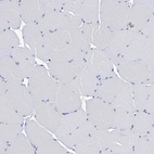 Immunohistochemical staining of human skeletal muscle shows no cytoplasmic positivity in myocytes.