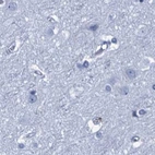 Immunohistochemical staining of human cerebral cortex using Anti-CYP51A1 antibody HPA041325.