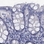 Immunohistochemical staining of human colon using Anti-CYP51A1 antibody HPA041325.