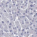 Immunohistochemical staining of human liver using Anti-CYP51A1 antibody HPA041325.