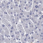 Anti-CYP51A1 Antibody