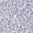 Immunohistochemical staining of human liver using Anti-CYP51A1 antibody HPA041325.