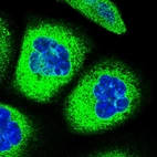 Immunofluorescent staining of human cell line A-431 shows localization to endoplasmic reticulum.