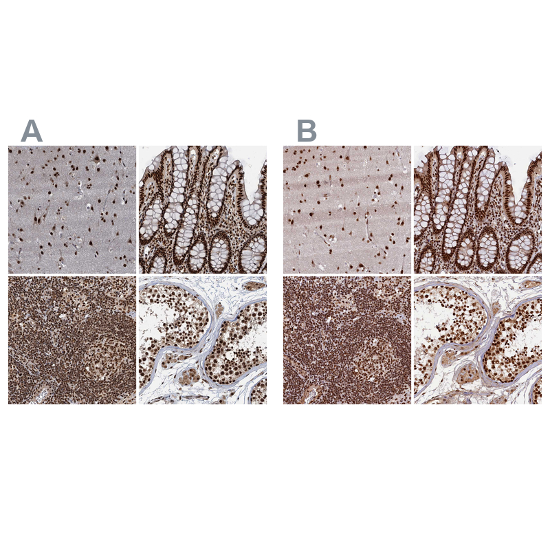 Anti-ZC3H18 Antibody