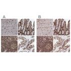 Anti-ZC3H18 Antibody