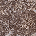 Immunohistochemical staining of human lymph node shows strong nuclear positivity in non-germinal center cells.