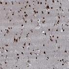 Immunohistochemical staining of human cerebral cortex shows strong nuclear positivity in neurons.