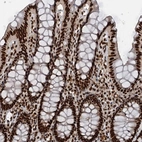 Immunohistochemical staining of human colon shows strong nuclear positivity in glandular cells.