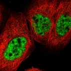 Immunofluorescent staining of human cell line A-431 shows localization to nuclear speckles.