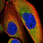 Immunofluorescent staining of human cell line A-431 shows localization to cytosol.