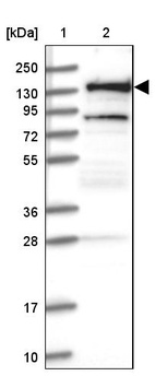 Lane 1: Marker [kDa] 250, 130, 95, 72, 55, 36, 28, 17, 10_br/_Lane 2: Human cell line RT-4