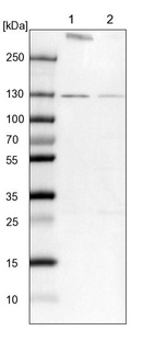 Lane 1: NIH-3T3 cell lysate (Mouse embryonic fibroblast cells)_br/_Lane 2: NBT-II cell lysate (Rat Wistar bladder tumour cells)