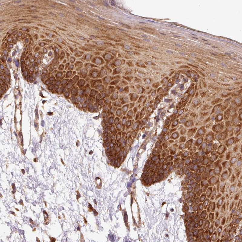 Anti-EIF2S2 Antibody
