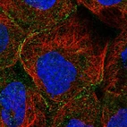 Immunofluorescent staining of human cell line A-431 shows localization to vesicles.