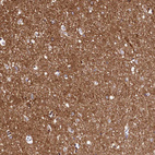 Immunohistochemical staining of human cerebral cortex shows strong membranous positivity in neuropil.