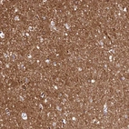 Immunohistochemical staining of human cerebral cortex shows strong membranous positivity in neuropil.