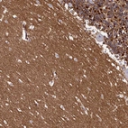 Immunohistochemical staining of human cerebellum shows strong membranous positivity in cells in molecular layer.