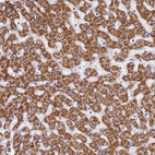 Immunohistochemical staining of human liver shows moderate granular cytoplasmic positivity in hepatocytes.