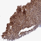 Immunohistochemical staining of human urinary bladder shows strong nuclear positivity in urothelial cells.