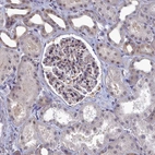 Immunohistochemical staining of human kidney shows moderate nuclear positivity in subset of cells in glomeruli.