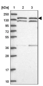 Lane 1: Marker [kDa] 250, 130, 95, 72, 55, 36, 28, 17, 10_br/_Lane 2: Human cell line RT-4_br/_Lane 3: Human cell line U-251MG sp