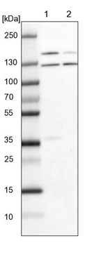 Lane 1: NIH-3T3 cell lysate (Mouse embryonic fibroblast cells)_br/_Lane 2: NBT-II cell lysate (Rat Wistar bladder tumour cells)