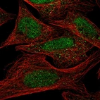 Immunofluorescent staining of human cell line U-2 OS shows positivity in nucleus.