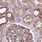 Immunohistochemical staining of human kidney shows moderate cytoplasmic positivity in cells in tubules.