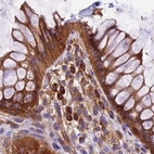 Immunohistochemical staining of human colon shows strong cytoplasmic positivity in glandular cells.