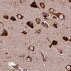 Immunohistochemical staining of human cerebral cortex shows strong cytoplasmic positivity in neuronal cells.