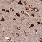 Immunohistochemical staining of human cerebral cortex shows strong cytoplasmic positivity in neuronal cells.