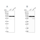 Western blot analysis using Anti-KARS antibody HPA041345 (A) shows similar pattern to independent antibody HPA041550 (B).