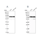 Western blot analysis using Anti-KARS antibody HPA041345 (A) shows similar pattern to independent antibody HPA041550 (B).