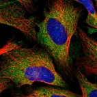 Immunofluorescent staining of human cell line U-2 OS shows localization to cytosol.