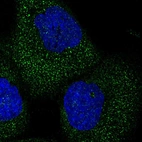 Immunofluorescent staining of human cell line A-431 shows localization to cytosol.