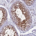 Immunohistochemical staining of human testis shows high expression.