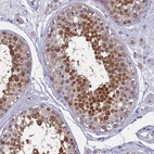 Immunohistochemical staining of human testis shows high expression.