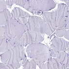 Immunohistochemical staining of human skeletal muscle shows low expression as expected.