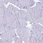 Immunohistochemical staining of human skeletal muscle shows low expression as expected.