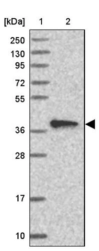 Lane 1: Marker [kDa] 250, 130, 95, 72, 55, 36, 28, 17, 10_br/_Lane 2: Human cell line RT-4
