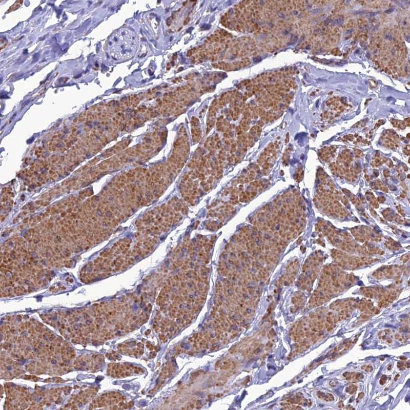 Anti-NKD1 Antibody