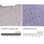 Anti-CACNG8 Antibody