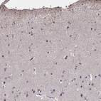 Immunohistochemical staining of human cerebral cortex shows high expression.