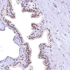 Anti-FLYWCH2 Antibody
