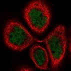 Immunofluorescent staining of human cell line A-431 shows localization to nucleoplasm.