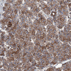 Anti-NMRAL1 Antibody